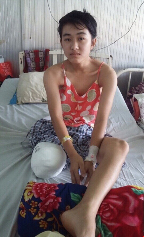 [-]Từ[-]vụ[-]nữ[-]sinh[-]bị[-]cắt[-]cụt[-]chân:[-]Vì[-]sao[-]không[-]chuyển[-]viện?