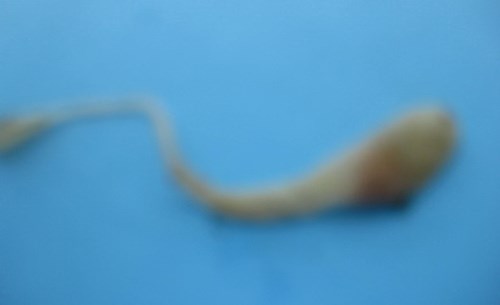 Hải[-]dương:[-]Phát[-]hiện[-]rắn[-]con[-]còn[-]sống[-]nằm[-]trong[-]trứng[-]gà[-]