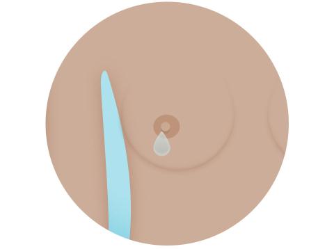 [-][-]9[-]dấu[-]hiệu[-]nhận[-]biết[-]sớm[-]ung[-]thư[-]vú[-]ở[-]chị[-]em