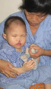 Câu[-]chuyện[-]của[-]bé[-]Quý[-]Tỵ