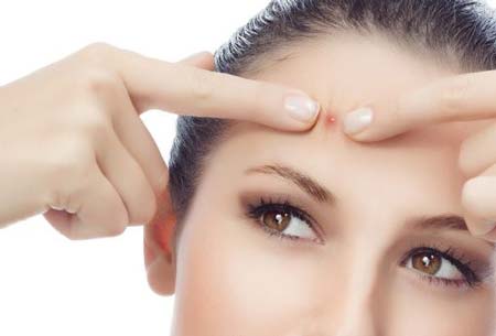Cách[-]loại[-]bỏ[-]mụn[-]tốt[-]nhất[-]không[-]gây[-]hỏng[-]da