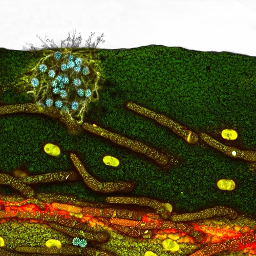 Ảnh[-]chụp[-]qua[-]kính[-]hiển[-]vi[-]-[-]những[-]tác[-]phẩm[-]đẹp[-]nhất