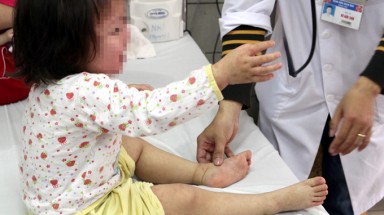  Sởi lan nhanh tại Hà Nội