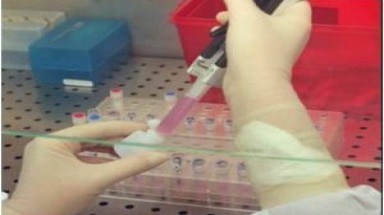  Phát hiện mã gen gây nên bệnh ung thư thực quản