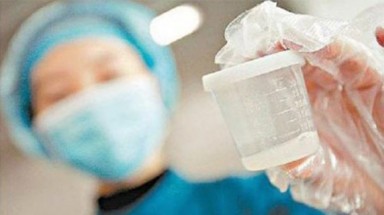   4 cách giúp tinh trùng mạnh hơn, nhanh hơn