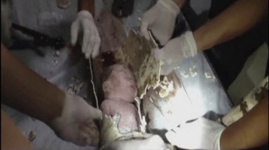  Bé sơ sinh bị nhét vào ống xả thải