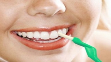  Tiền mất tật mang vì thuốc tẩy trắng răng