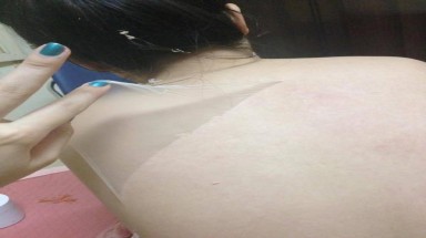     Nguy hại do lột da tắm trắng