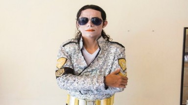  Người đàn ông tiêm axit lên mặt để có làn da trắng như... Michael Jackson 