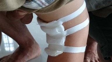  Bệnh viện Đa khoa tỉnh Vĩnh Long : Chỉ định mổ chân trái, bác sĩ mổ chân phải