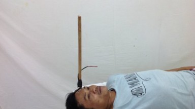   Tây Ninh: Trộm chó bắn chĩa ghim giữa trán người đuổi bắt