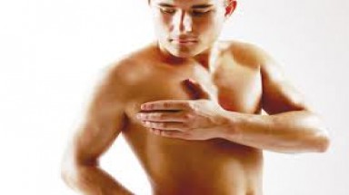  Chứng vú to ở nam giới