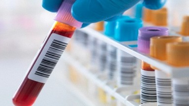  Đáng ngạc nhiên là hàng nghìn người không biết mình nhiễm HIV