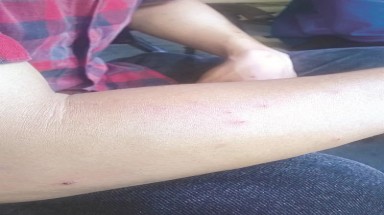   Côn trùng lạ tấn công người dân